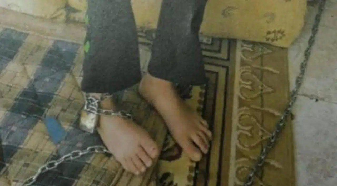 13 yaşındaki kız çocuğunu zincire bağladılar