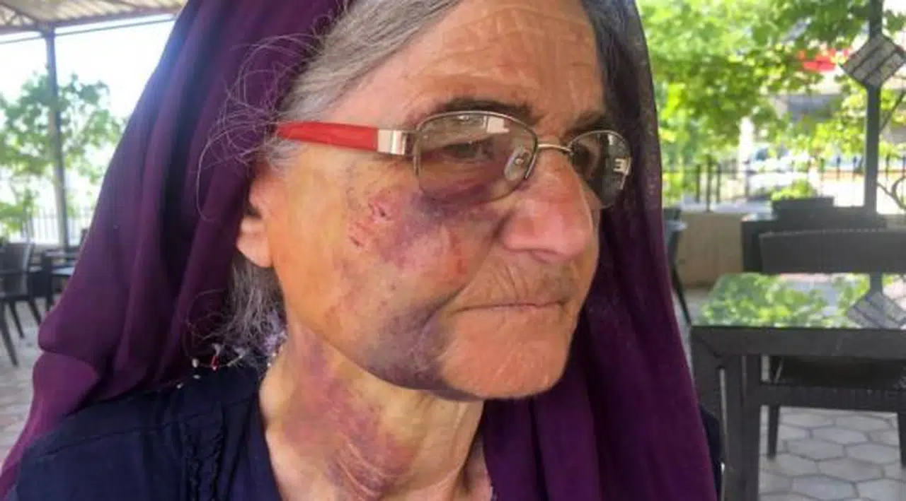 Kuzusunu sürüden almak isterken saldırıya uğradı