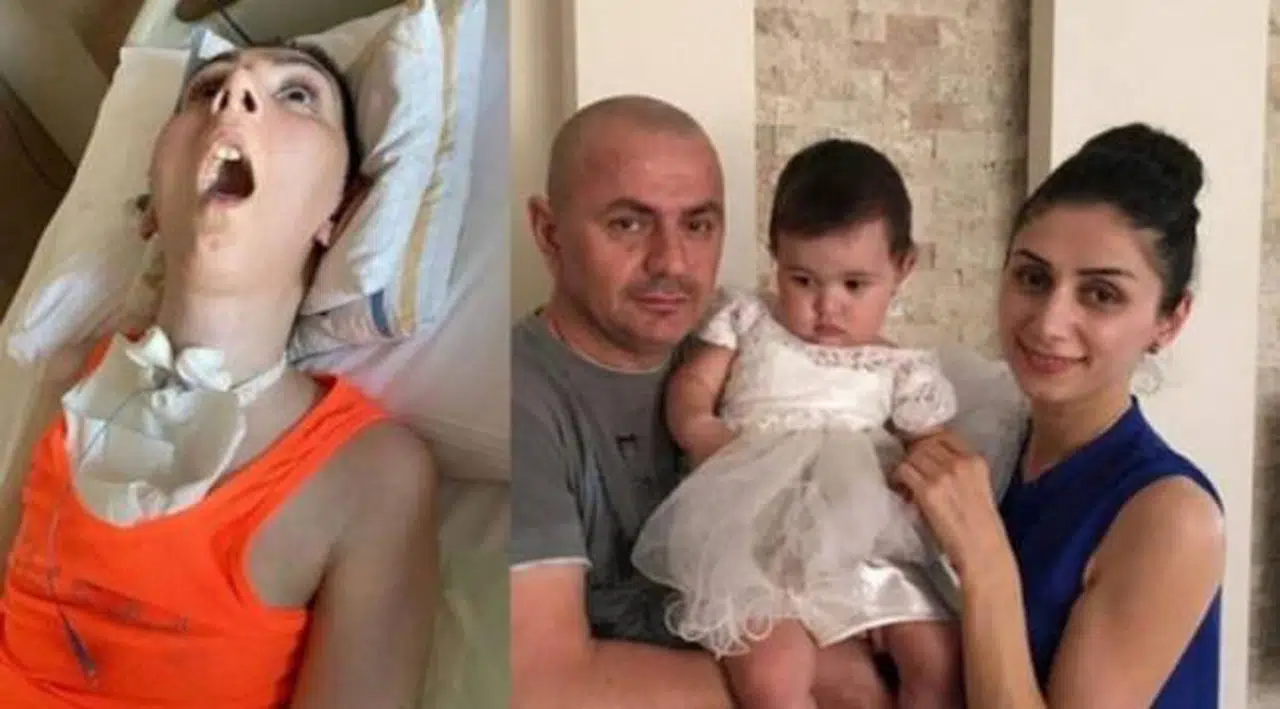 Estetik ameliyat sonrası 4 yıl hastanede yattı: Polis zoruyla evine gönderildi