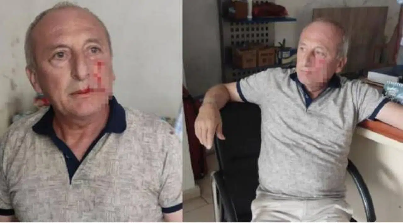 CHP'li belediye başkanı saldırıya uğradı