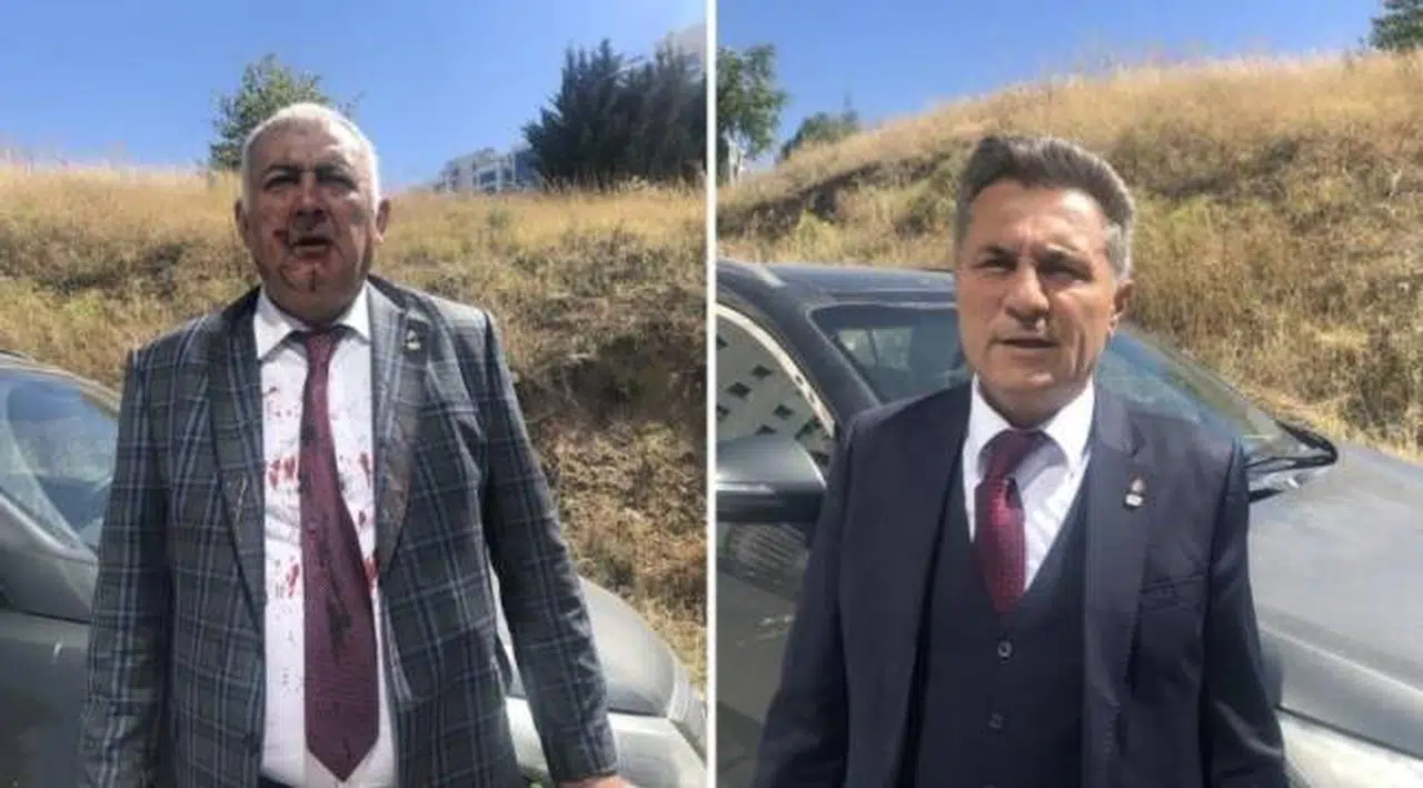 Zafer Partisi'nde 'kanlı' istifa: 'Ümit Özdağ'ın azmettirmesiyle 20 kişi beni ve arkadaşımı darp etti'