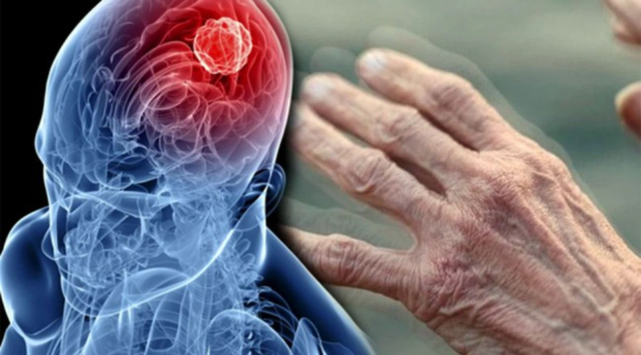 Parkinson Hastaları Dikkat !