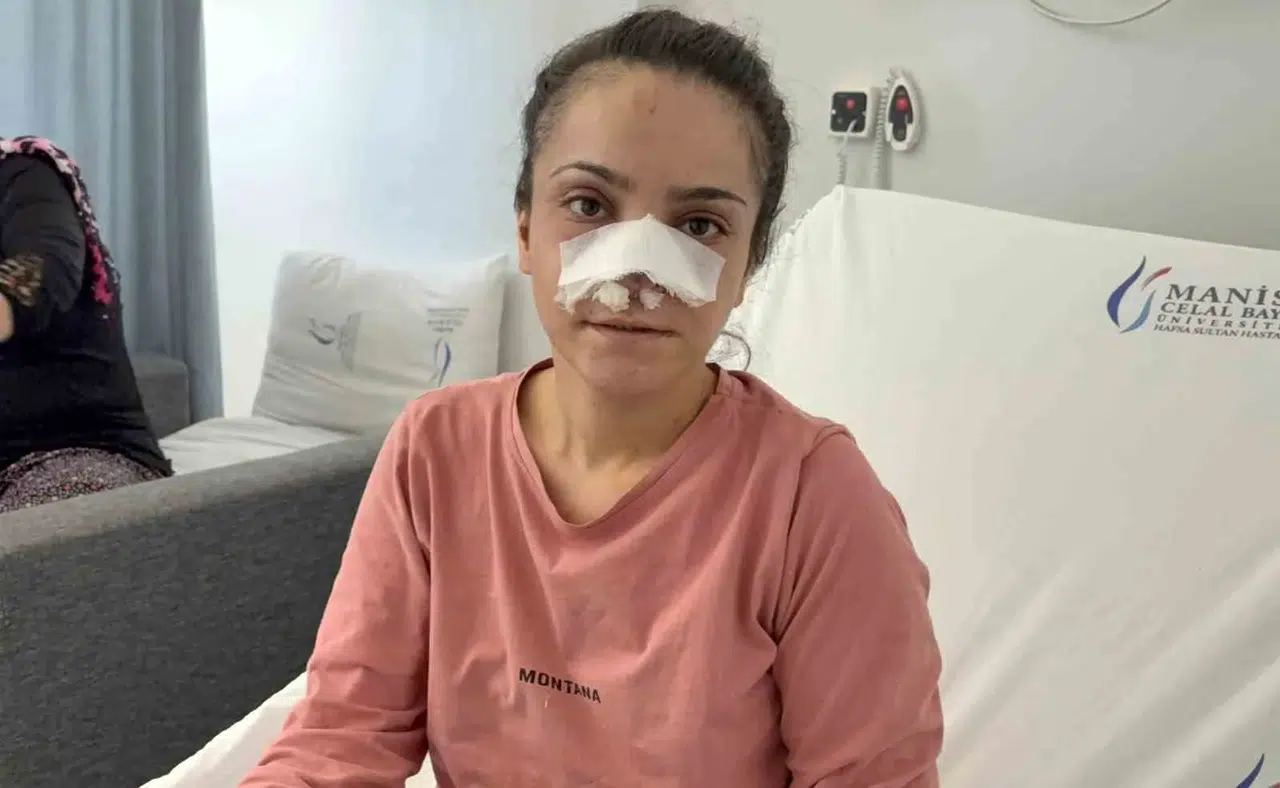 Turgutlu'da dehşet gecesi: Eşinin kopardığı burun cerrahi müdahaleyle kurtarıldı