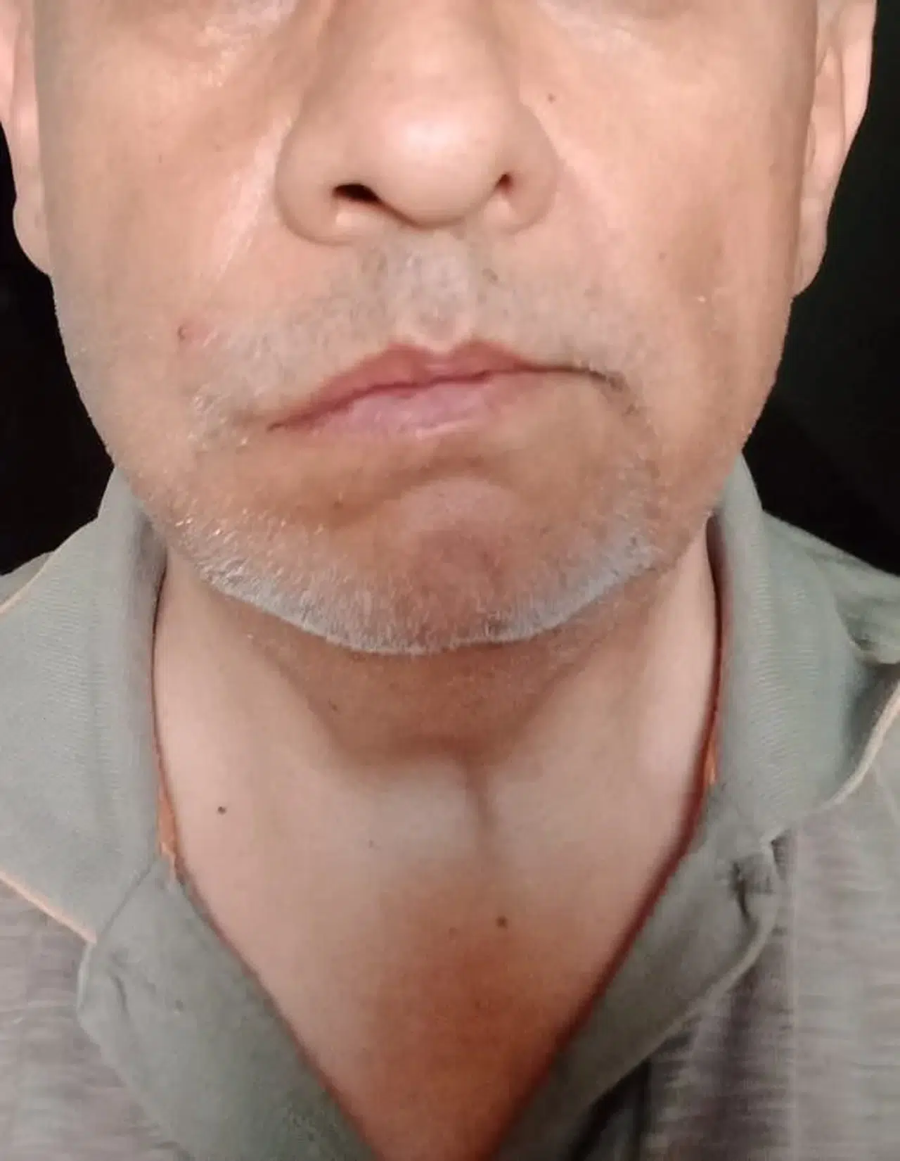 Otobüste su krizi kanlı bitti: Doktor yolcuya muavin şiddeti