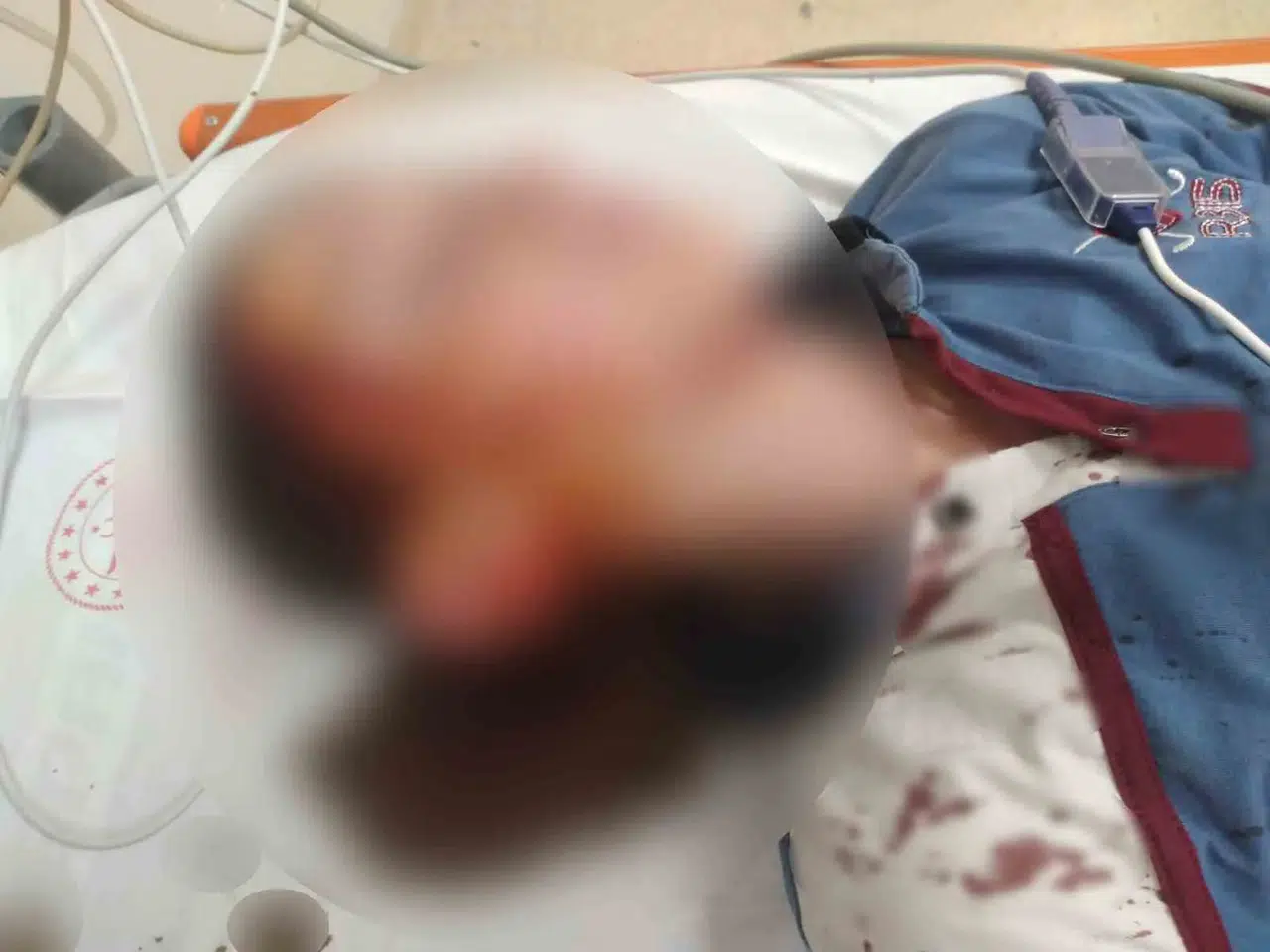 Bakkal yolunda kabusu yaşadı: Köpek saldırısı sonrası mahkemeden emsal karar