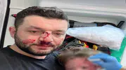Bebeğinin kafatasını çatlatan komşu için tahliye kararı verildi
