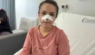 Turgutlu'da dehşet gecesi: Eşinin kopardığı burun cerrahi müdahaleyle kurtarıldı
