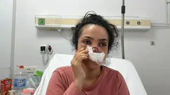 Alkolün gölgesinde kavga: Eşinin burnunu ısırıp kopardı, itfaiye balkondan tahliye etti