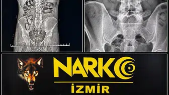İzmir Havalimanı'nda midesi uyuşturucu dolu yolculara geçit yok