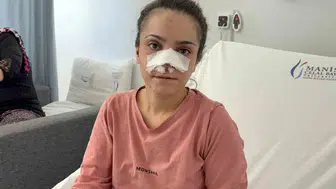 Turgutlu'da dehşet gecesi: Eşinin kopardığı burun cerrahi müdahaleyle kurtarıldı