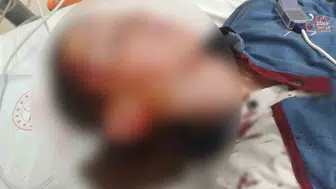 Bakkal yolunda kabusu yaşadı: Köpek saldırısı sonrası mahkemeden emsal karar