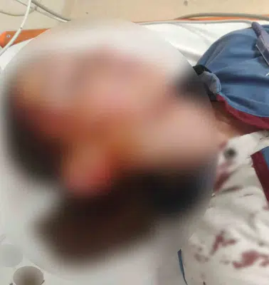 Bakkal yolunda kabusu yaşadı: Köpek saldırısı sonrası mahkemeden emsal karar