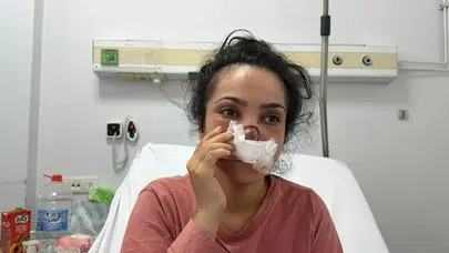 Alkolün gölgesinde kavga: Eşinin burnunu ısırıp kopardı, itfaiye balkondan tahliye etti