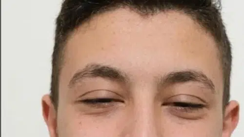 Denizli'de scooter faciası: 11 günlük yaşam savaşı acı bitti