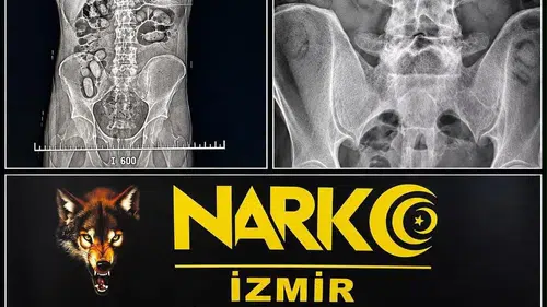 İzmir Havalimanı'nda midesi uyuşturucu dolu yolculara geçit yok