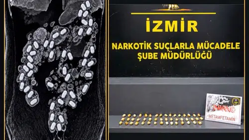 Midesinde zehir taşıyordu: Havalimanındaki narkotik operasyonunda şok detay