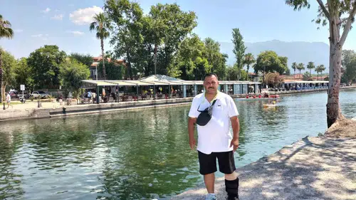 Hizmet aşkı engel tanımıyor: Ayağı alçıda olmasına rağmen sahadan ayrılmadı