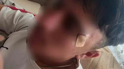 Eğitim yuvasında şiddet skandalı: Öğretmen öğrencisinin burnunu kırdı