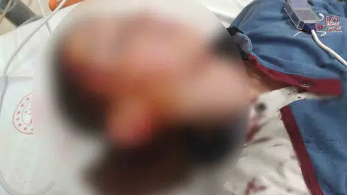 Bakkal yolunda kabusu yaşadı: Köpek saldırısı sonrası mahkemeden emsal karar