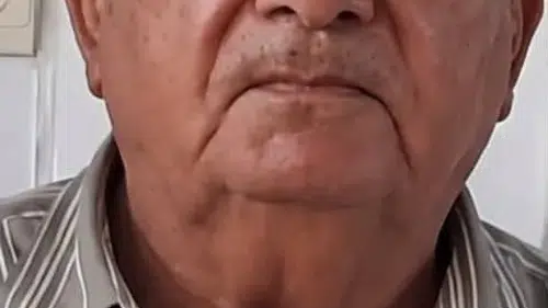 Denizli'de acı dolu anlar: Park etmeye çalıştığı bisikletiyle inşaat çukuruna uçtu