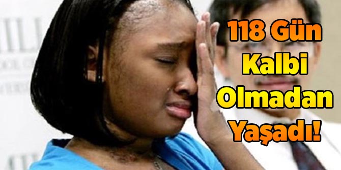 118 Gün Kalbi Olmadan Yaşadı!