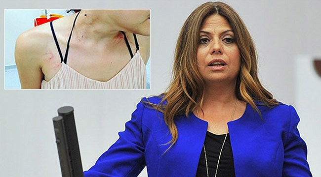 Darp Edilen Müzisyen Gülşah Erol Meclis Gündeminde