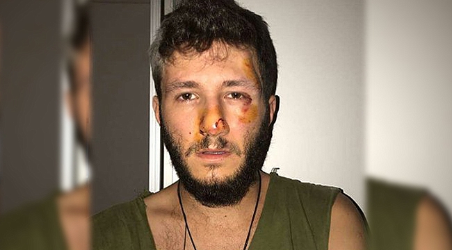 İzmir Konak'ta Homofobik Saldırı