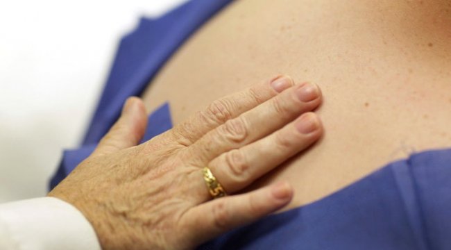 Avustralyalı Araştırmacılar Cilt Kanserini Durduran Bir Yöntem Buldular