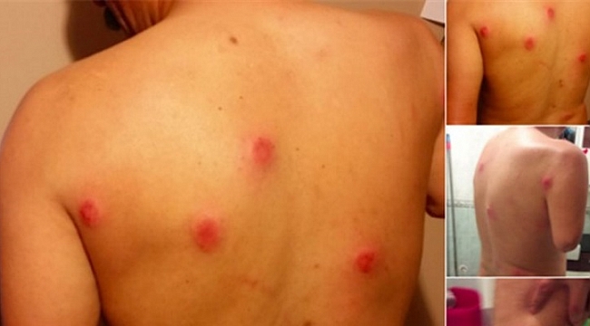 Saçılık’a Onlarca Plastik Mermi Sıkan Polislere Takipsizlik: Müdahale Ölçülüymüş