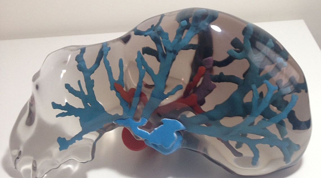 Dokuz Eylül Üniversitesi'nden  karaciğer naklinde 3D devrimi