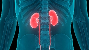 Ailesinde genç yaşta böbrek kanseri gelişen kişilerde risk üç kat daha fazla