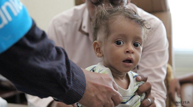 85 Bin Çocuk Hayatını Kaybetti