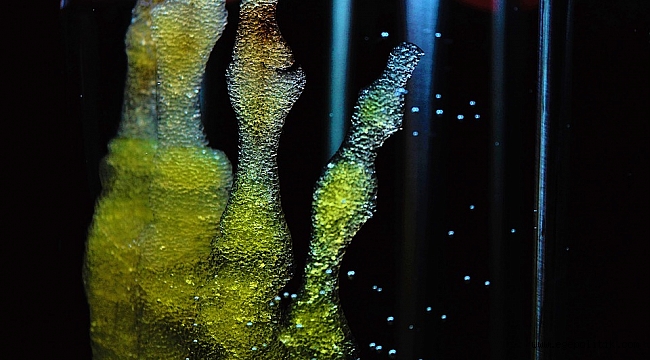 &quot;Kök Hücreden Saç Üretmek Kelliğin Çözümü Olabilir&quot;