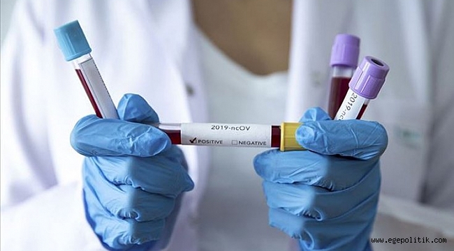 Hong Konglu bilim insanları: Salgının temmuza kadar kontrol altına alınması imkansız