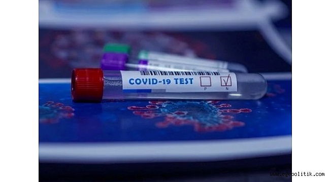 Bakan Koca' dan itiraf: 9,8 TL’lik kiti Bakanlığa 32 TL’ye satmışlar