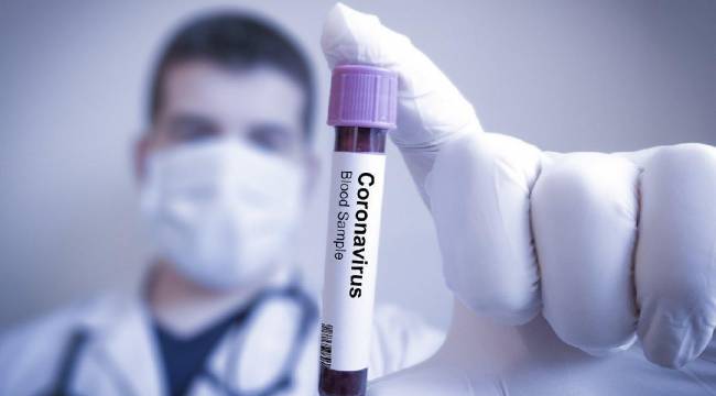 Varyantlı vakalarda karantina süresi en az 10 gün olacak