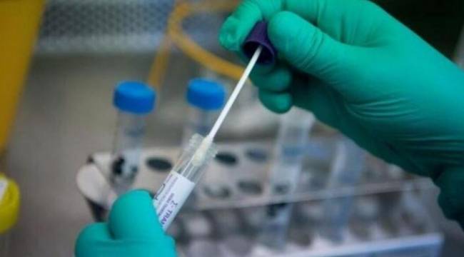 Bir telefonla sahte PCR testi veriliyor: &#039;Gelmenize gerek yok, test yarın elinizde!&#039;