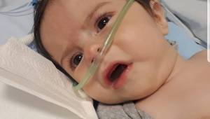 SMA hastası Muzaffer Bebek yaşam mücadelesi veriyor!