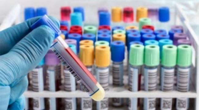 Sağlık Bakanı: SMA tarama programı bugün başlıyor