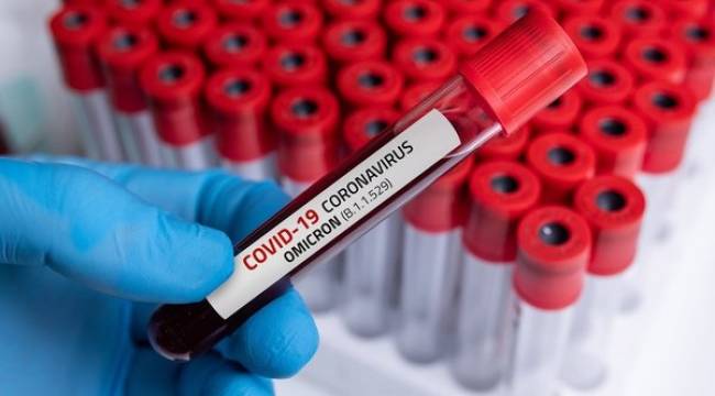 Bilim Kurulu üyesi 'bir ilk' diyerek duyurdu: 5 gün kritik