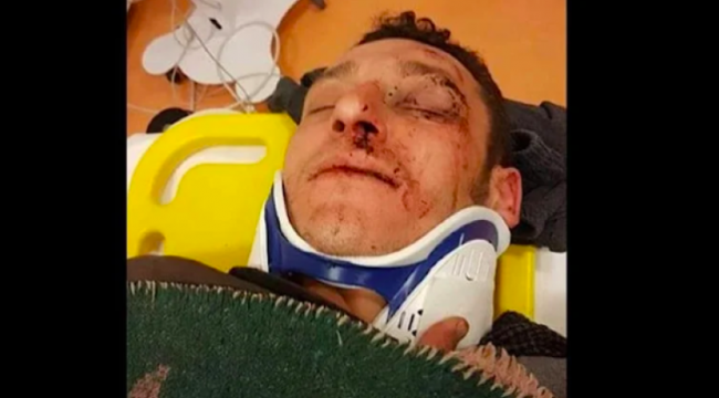 Seçimi kazanmak için rakip adayın seçmenini kaçırıp dövdüler