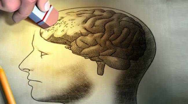 Alzheimer belirtilerini saptayabilen kan testi kiti onaylandı