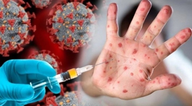 Maymun çiçeği virüsüne karşı ilk aşıya onay