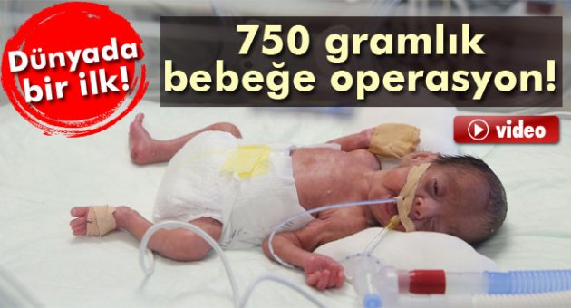 750 gram bebeğe operasyon