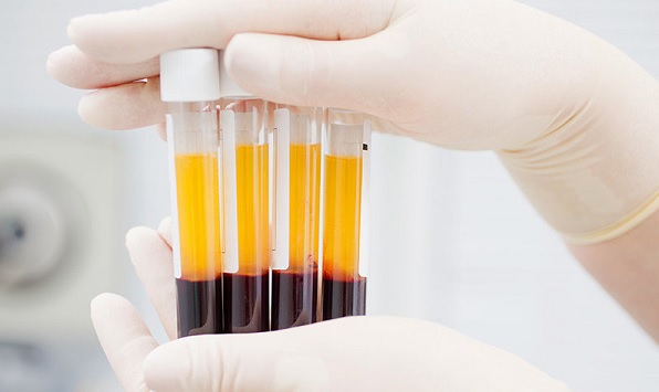 Korona, İmmün Plazma Tedavisi ve Merak Edilenleri Dr. Merve Bozkurt Kaya Yanıtladı