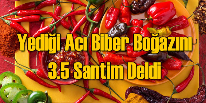 Acı Biber Yarışmasında Acı Son