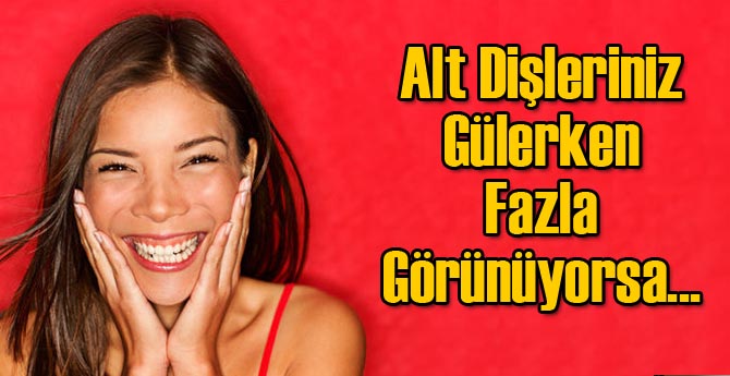 Alt Dişleriniz Gülerken Fazla Görünüyorsa...