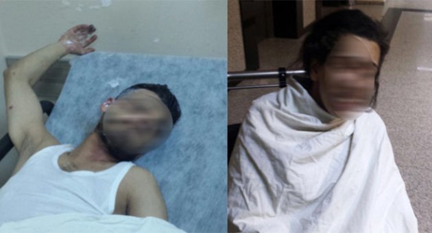 Araç kundaklarken kendini ve sevgilisini yaktı