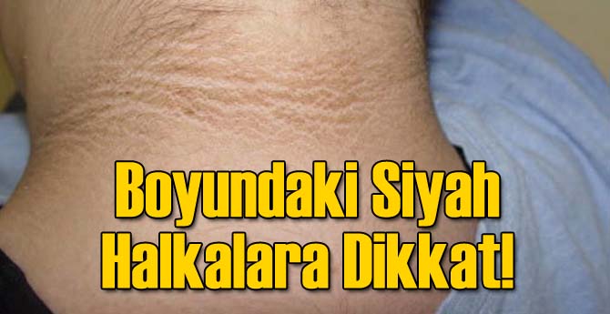 Aziz Yıldırım Volkan Konusunda Noktayı Koydu!