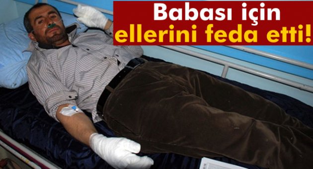 Babasını kurtarmak için ellerini feda etti